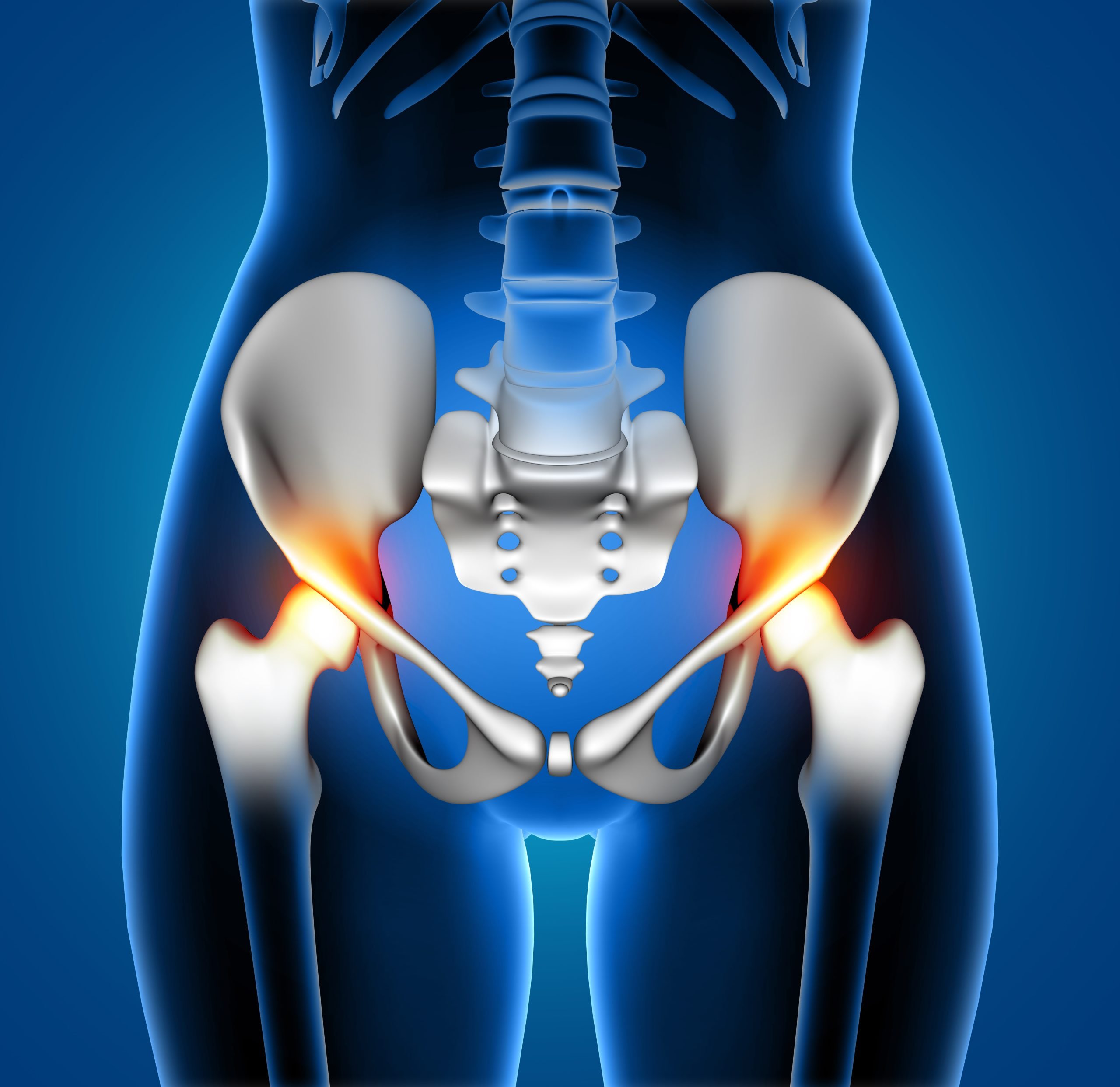 Hip replacement rehab in Nottingham